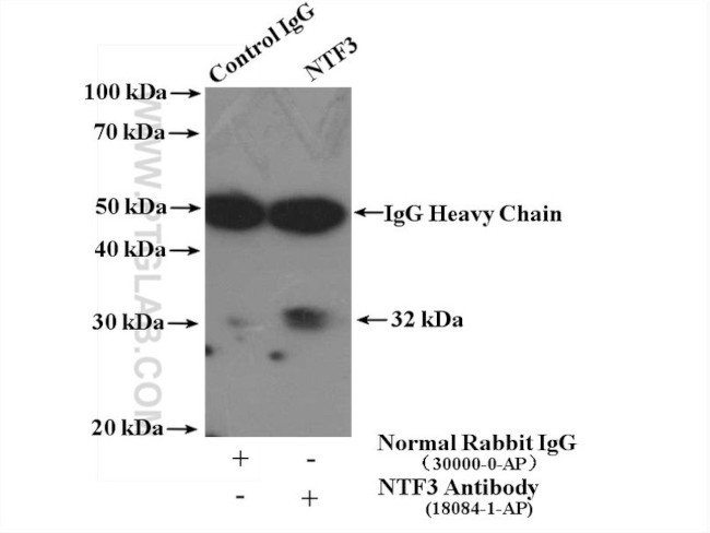 Neurotrophin 3 Antibody in Immunoprecipitation (IP)