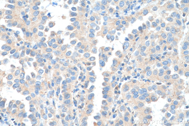 TEC Antibody in Immunohistochemistry (Paraffin) (IHC (P))