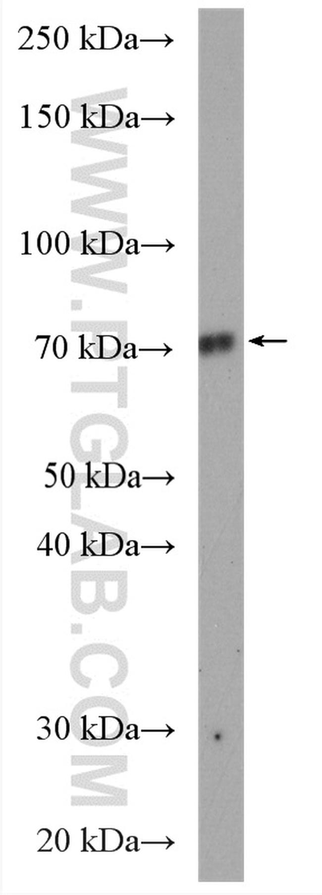 TEC Antibody in Western Blot (WB)