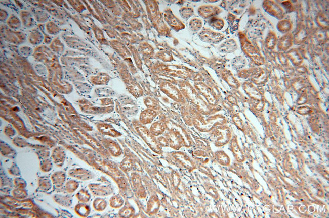 FARSA Antibody in Immunohistochemistry (Paraffin) (IHC (P))