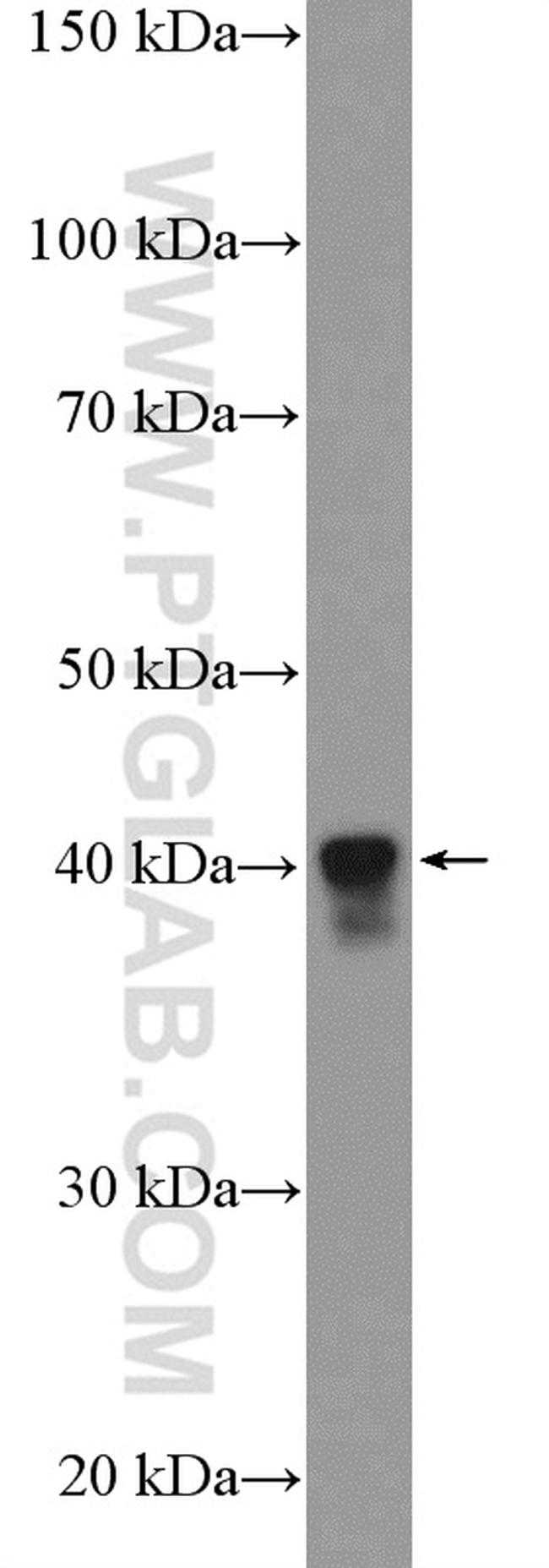 PURB Antibody in Western Blot (WB)