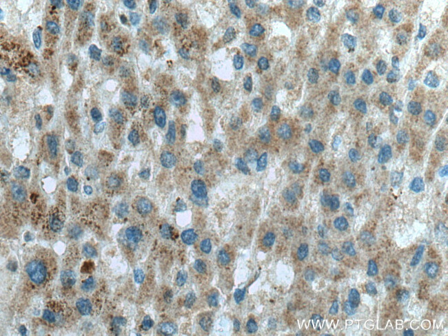 OTOR Antibody in Immunohistochemistry (Paraffin) (IHC (P))