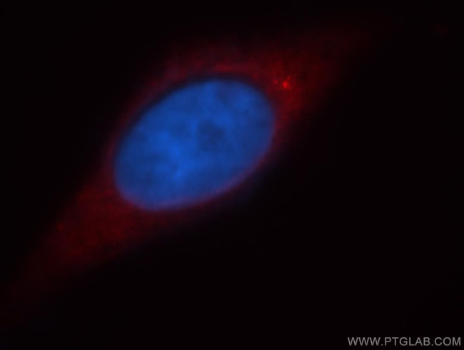 RAB11FIP2 Antibody in Immunocytochemistry (ICC/IF)