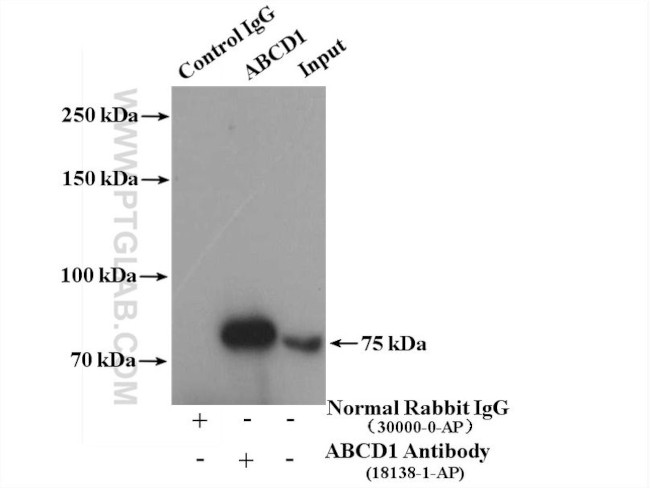 ABCD1 Antibody in Immunoprecipitation (IP)