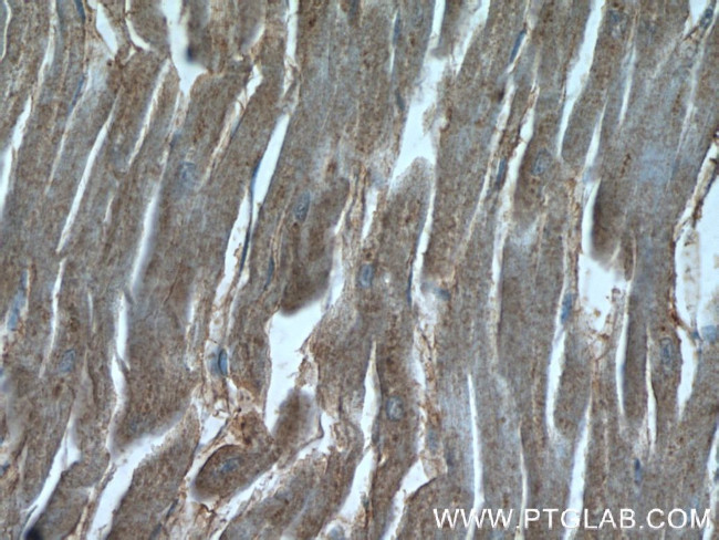 UBE4B Antibody in Immunohistochemistry (Paraffin) (IHC (P))