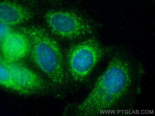 MMP13 Antibody in Immunocytochemistry (ICC/IF)