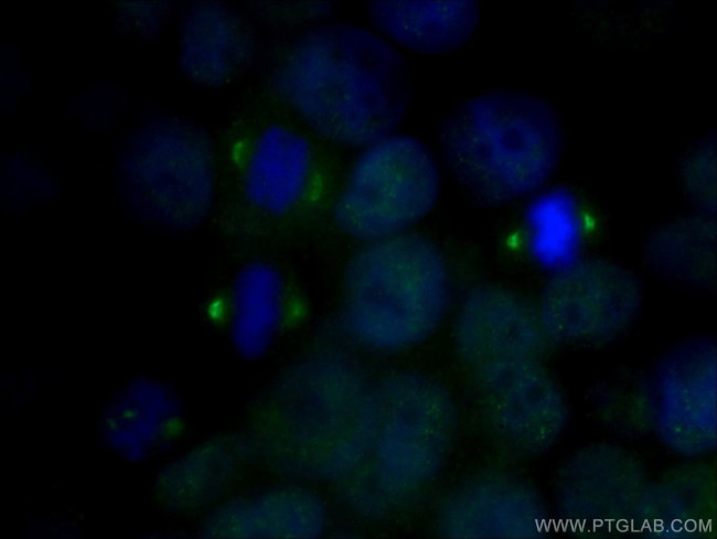 MMP13 Antibody in Immunocytochemistry (ICC/IF)