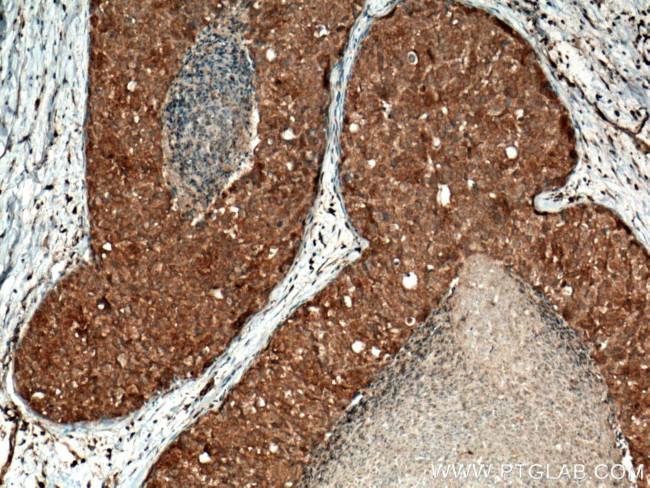 MMP13 Antibody in Immunohistochemistry (Paraffin) (IHC (P))