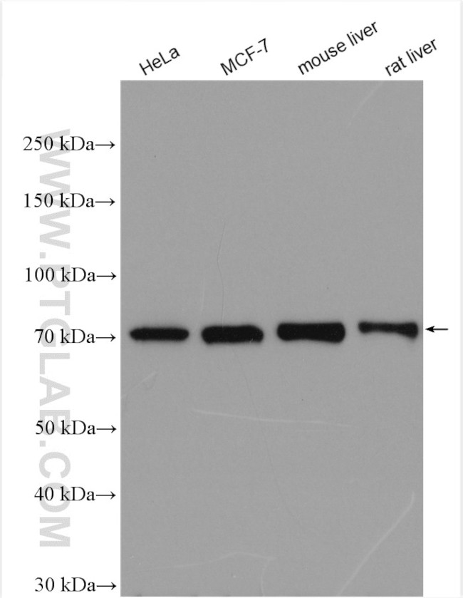 MMP13 Antibody in Western Blot (WB)