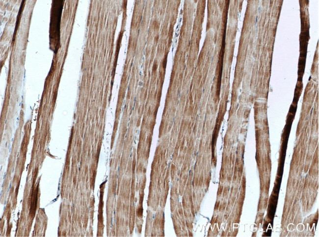 AMPK alpha 2 Antibody in Immunohistochemistry (Paraffin) (IHC (P))