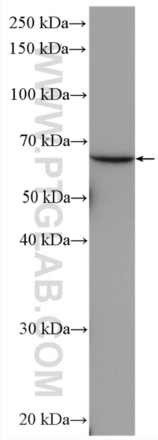 AMPK alpha 2 Antibody in Western Blot (WB)