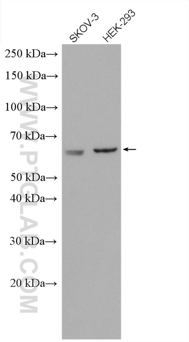 AMPK alpha 2 Antibody in Western Blot (WB)