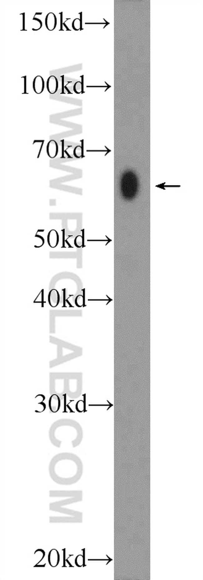 AMPK alpha 2 Antibody in Western Blot (WB)