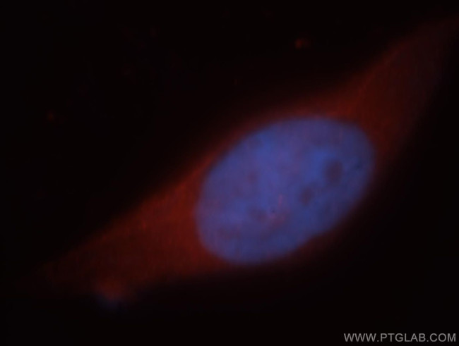 HEPACAM Antibody in Immunocytochemistry (ICC/IF)