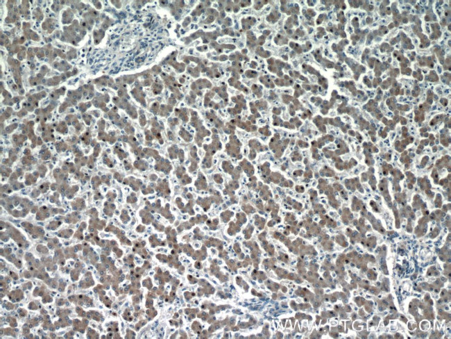 HEPACAM Antibody in Immunohistochemistry (Paraffin) (IHC (P))