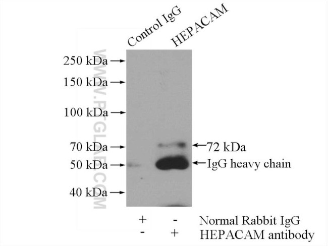 HEPACAM Antibody in Immunoprecipitation (IP)