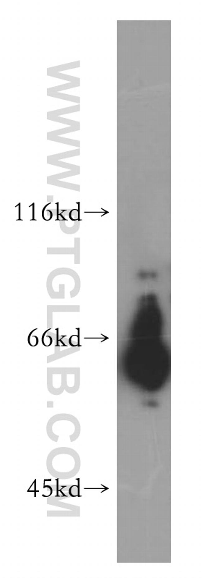 HEPACAM Antibody in Western Blot (WB)