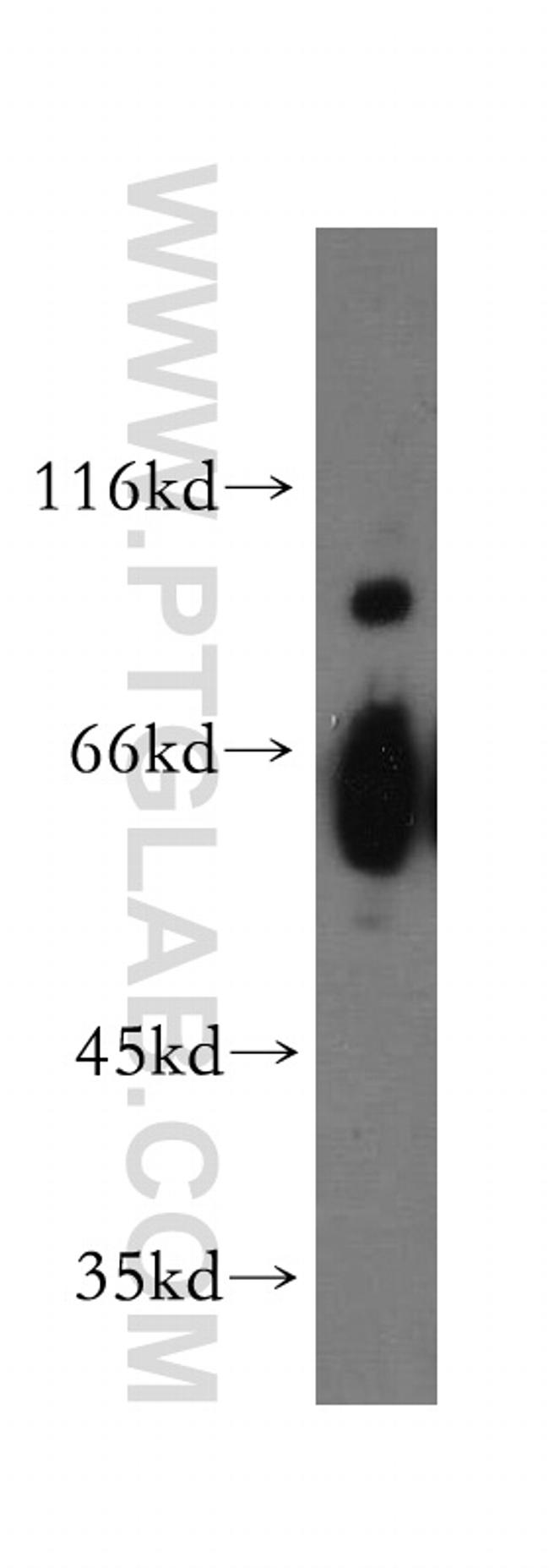 HEPACAM Antibody in Western Blot (WB)