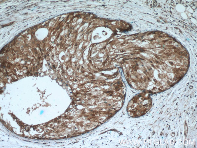 FUT7 Antibody in Immunohistochemistry (Paraffin) (IHC (P))