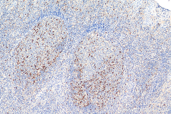 Cyclin A2 Antibody in Immunohistochemistry (Paraffin) (IHC (P))