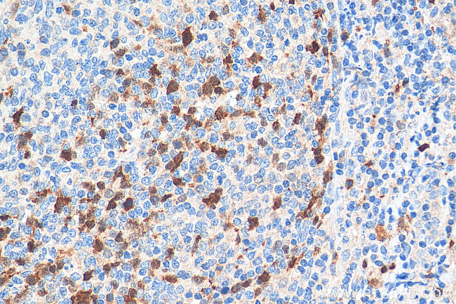 Cyclin A2 Antibody in Immunohistochemistry (Paraffin) (IHC (P))