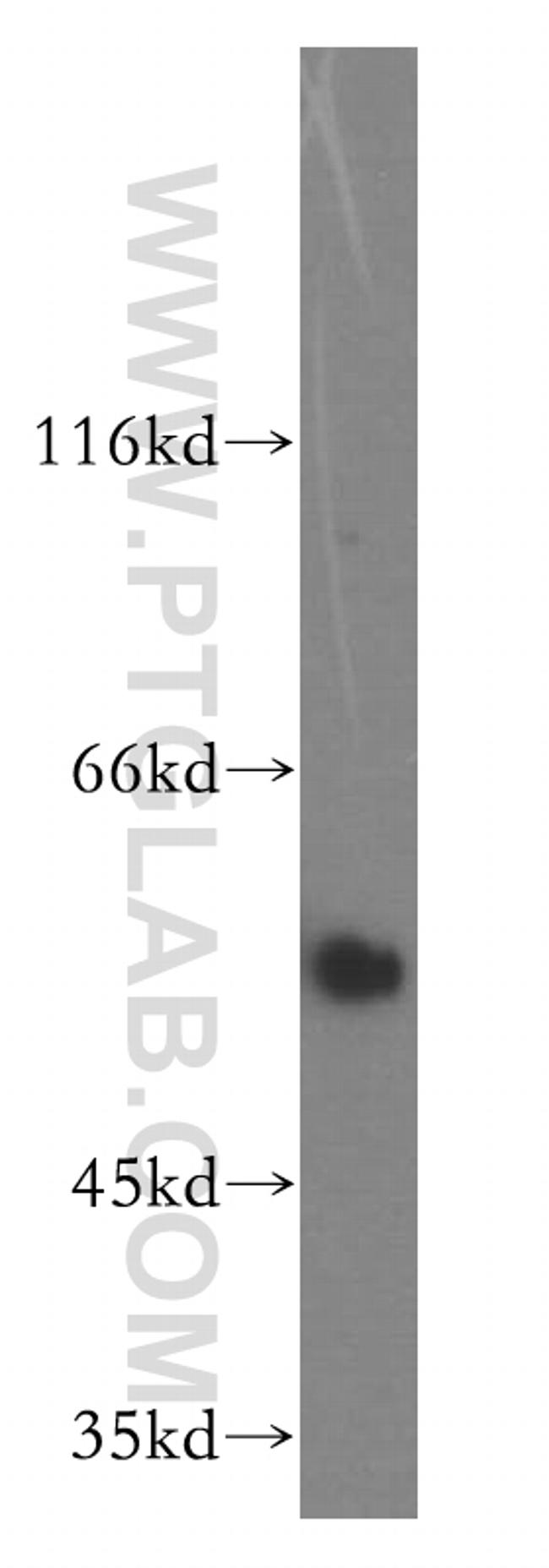 Cyclin A2 Antibody in Western Blot (WB)