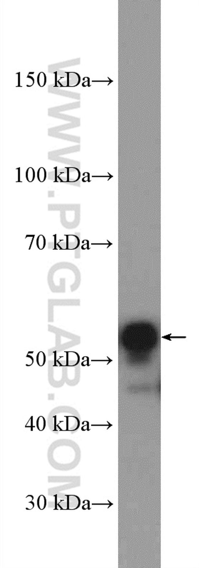 Cyclin A2 Antibody in Western Blot (WB)