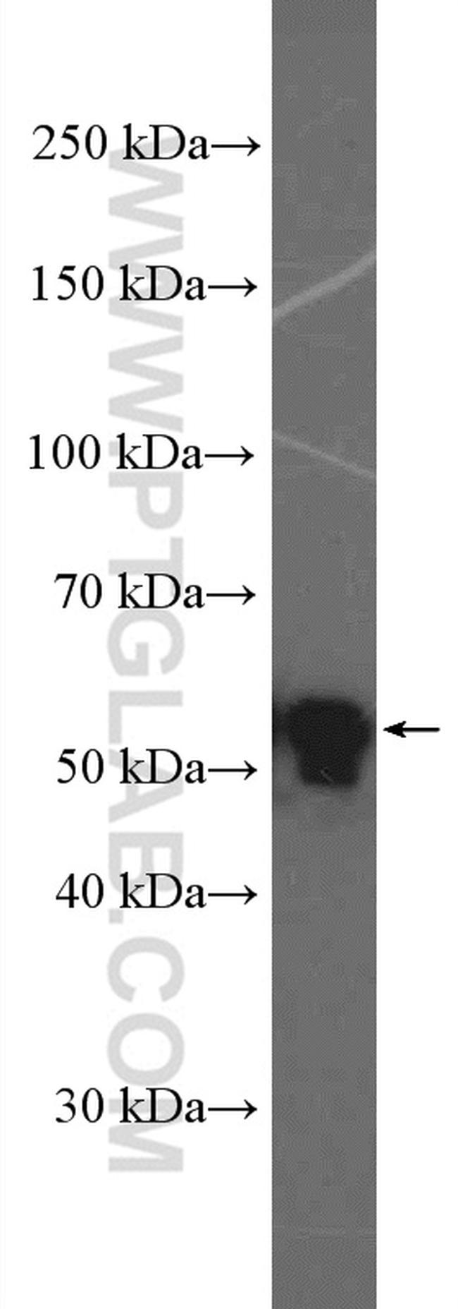 Cyclin A2 Antibody in Western Blot (WB)