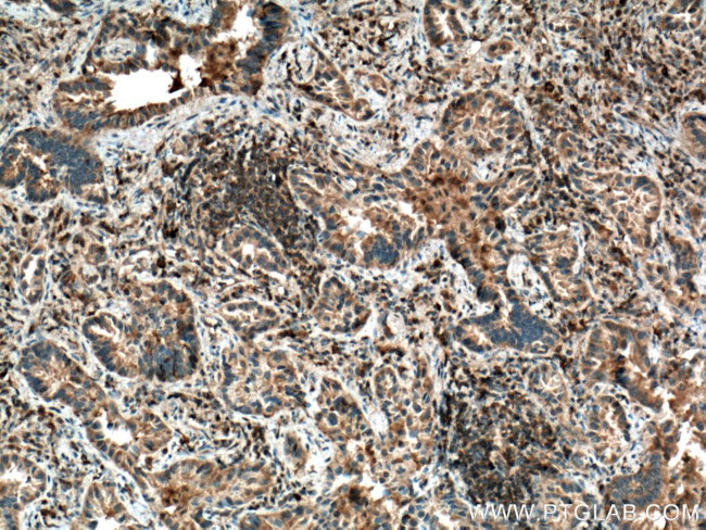 IRAK4 Antibody in Immunohistochemistry (Paraffin) (IHC (P))