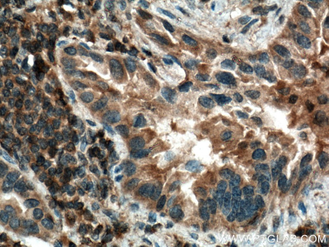 IRAK4 Antibody in Immunohistochemistry (Paraffin) (IHC (P))