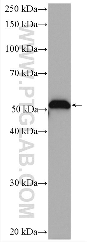 IRAK4 Antibody in Western Blot (WB)