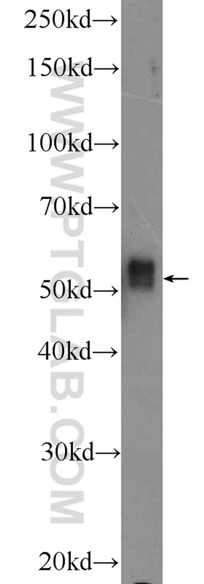 IRAK4 Antibody in Western Blot (WB)