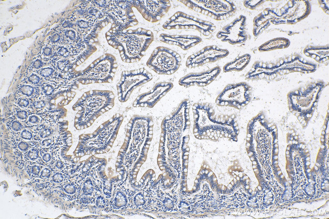 RETNLB Antibody in Immunohistochemistry (Paraffin) (IHC (P))