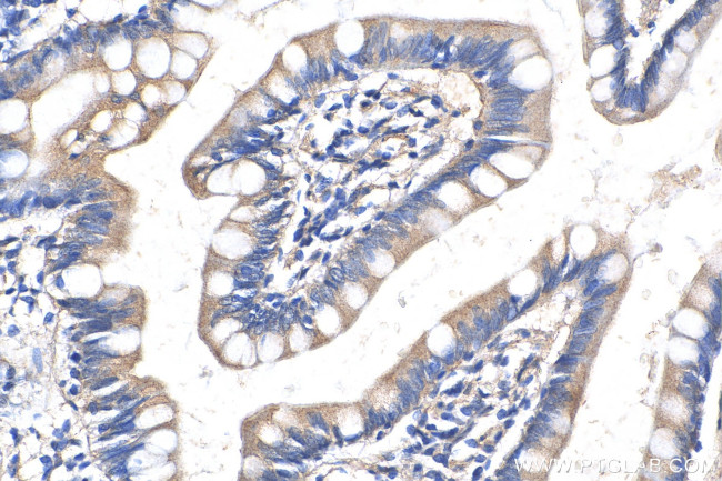 RETNLB Antibody in Immunohistochemistry (Paraffin) (IHC (P))