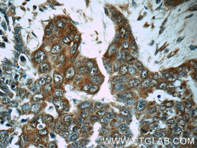 MMP28 Antibody in Immunohistochemistry (Paraffin) (IHC (P))