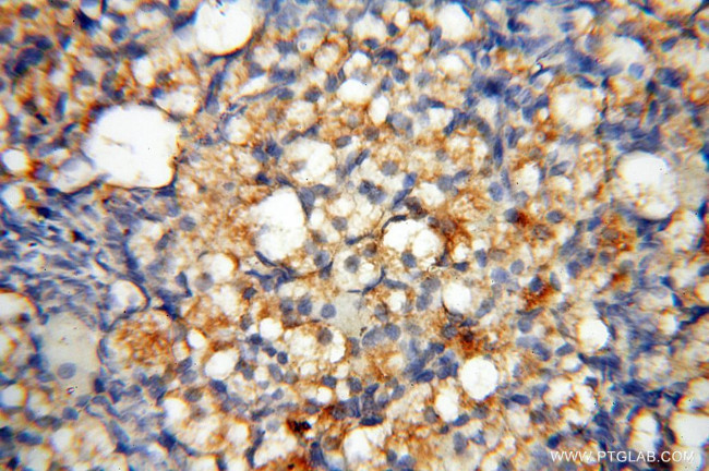 MMP28 Antibody in Immunohistochemistry (Paraffin) (IHC (P))