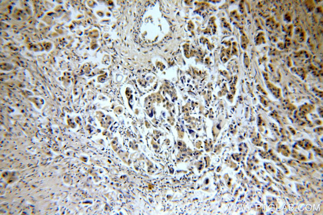 CHST3 Antibody in Immunohistochemistry (Paraffin) (IHC (P))