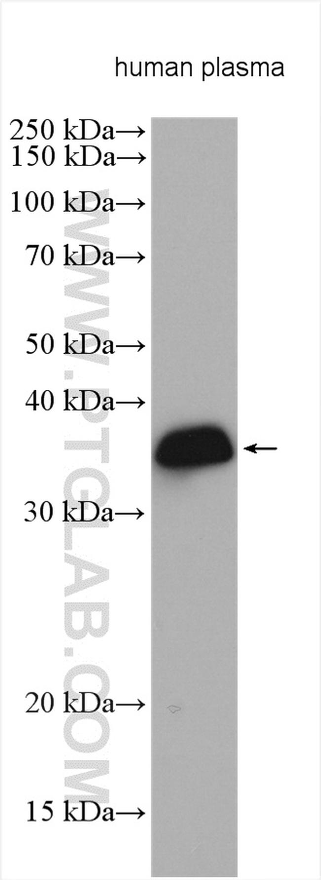 APOE Antibody in Western Blot (WB)