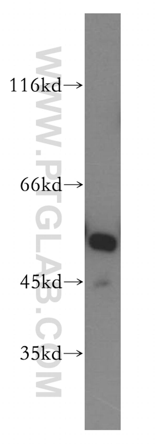 GSR Antibody in Western Blot (WB)