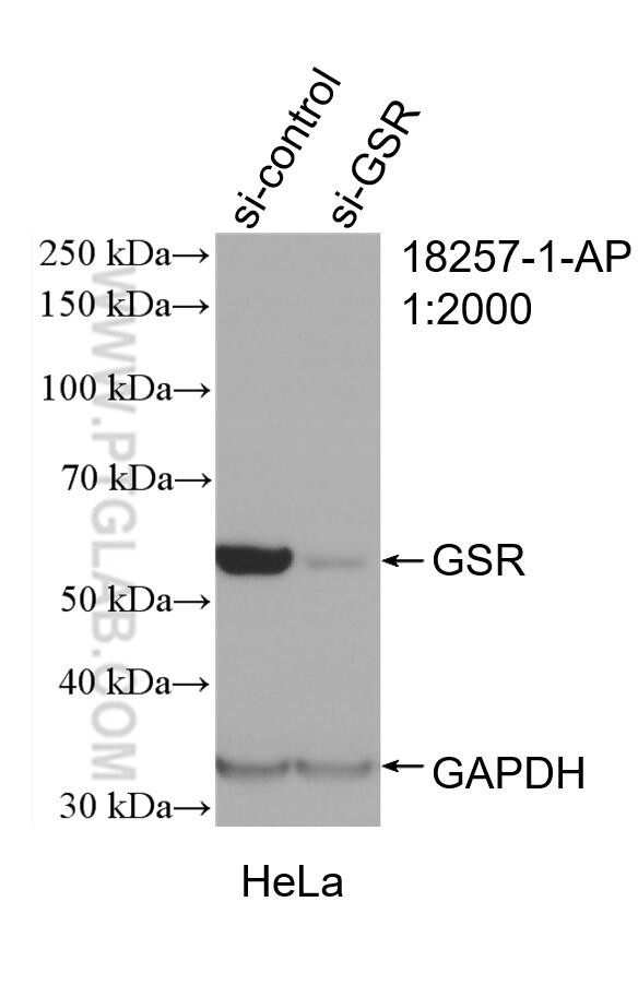 GSR Antibody in Western Blot (WB)