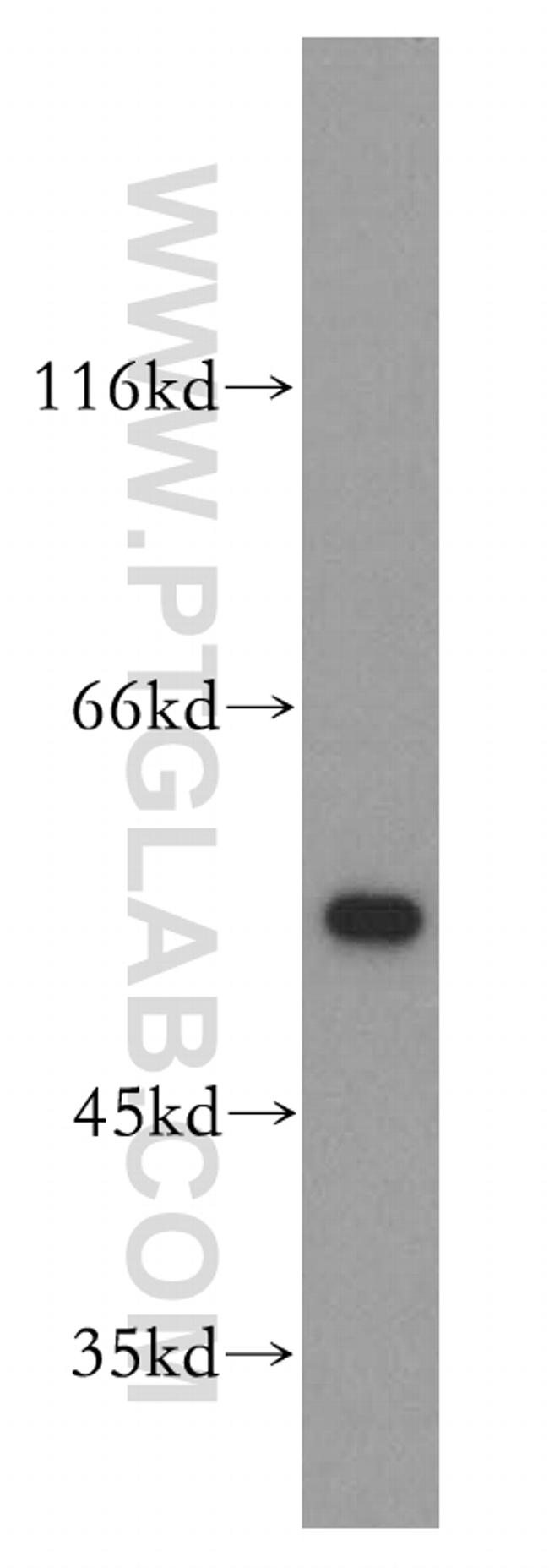 GSR Antibody in Western Blot (WB)