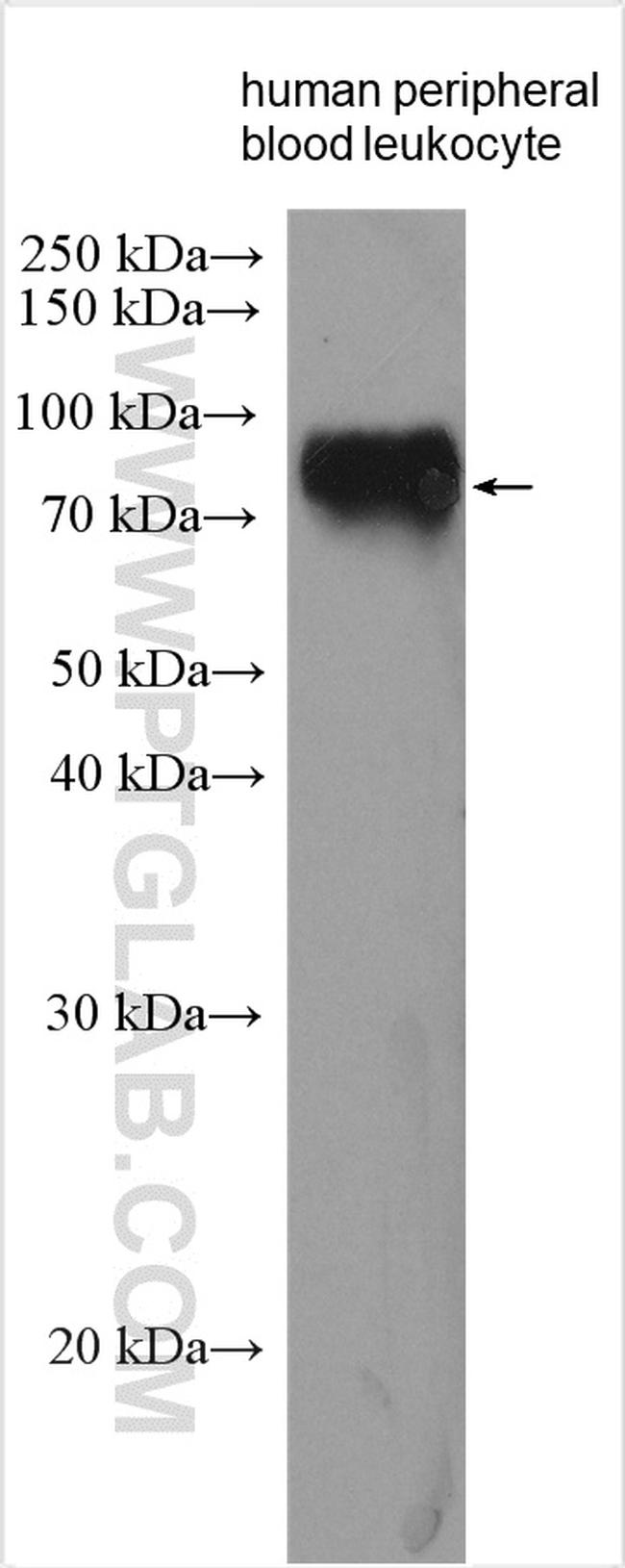 LILRB3 Antibody in Western Blot (WB)
