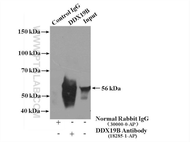 DDX19B Antibody in Immunoprecipitation (IP)