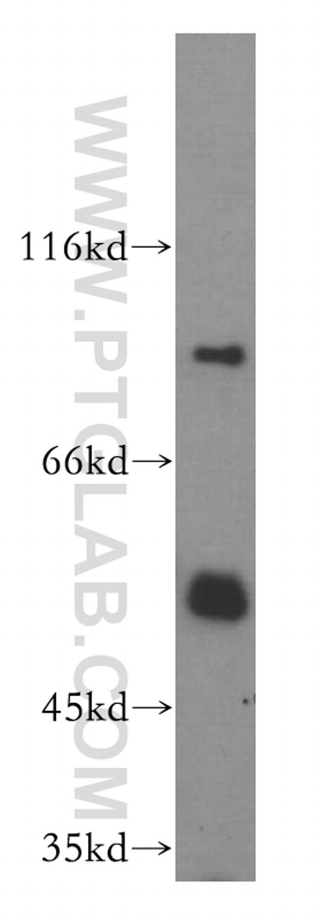 DDX19B Antibody in Western Blot (WB)