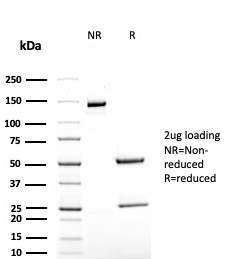 TAG-72/CA72.4 (Tumor-Associated Glycoprotein) Antibody in SDS-PAGE (SDS-PAGE)