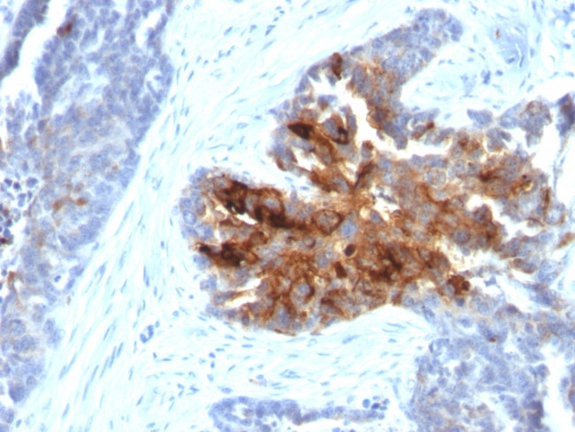 TAG-72/CA72.4 (Tumor-Associated Glycoprotein) Antibody in Immunohistochemistry (Paraffin) (IHC (P))