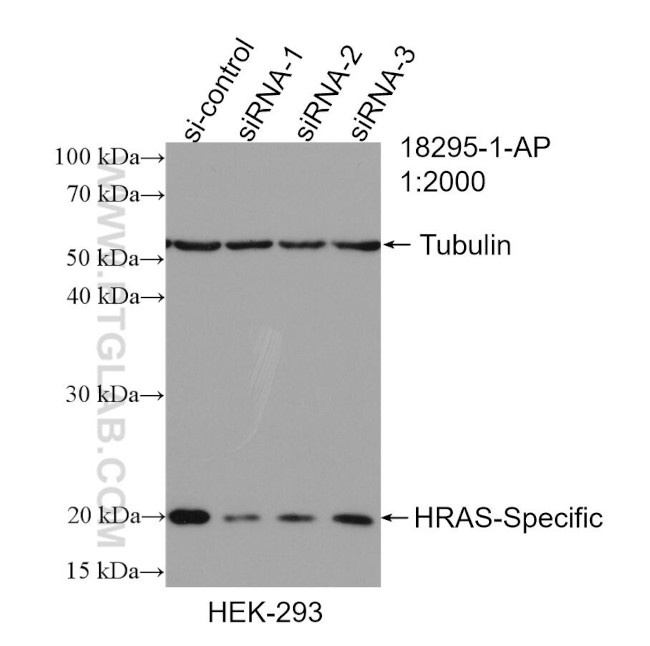 HRAS Antibody in Western Blot (WB)