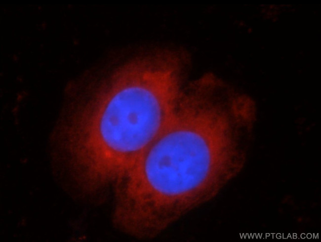 HRAS Antibody in Immunocytochemistry (ICC/IF)