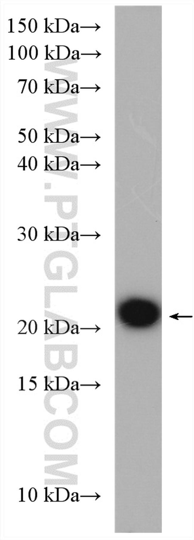 HRAS Antibody in Western Blot (WB)