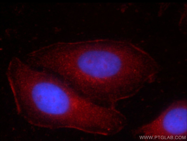 HRAS Antibody in Immunocytochemistry (ICC/IF)